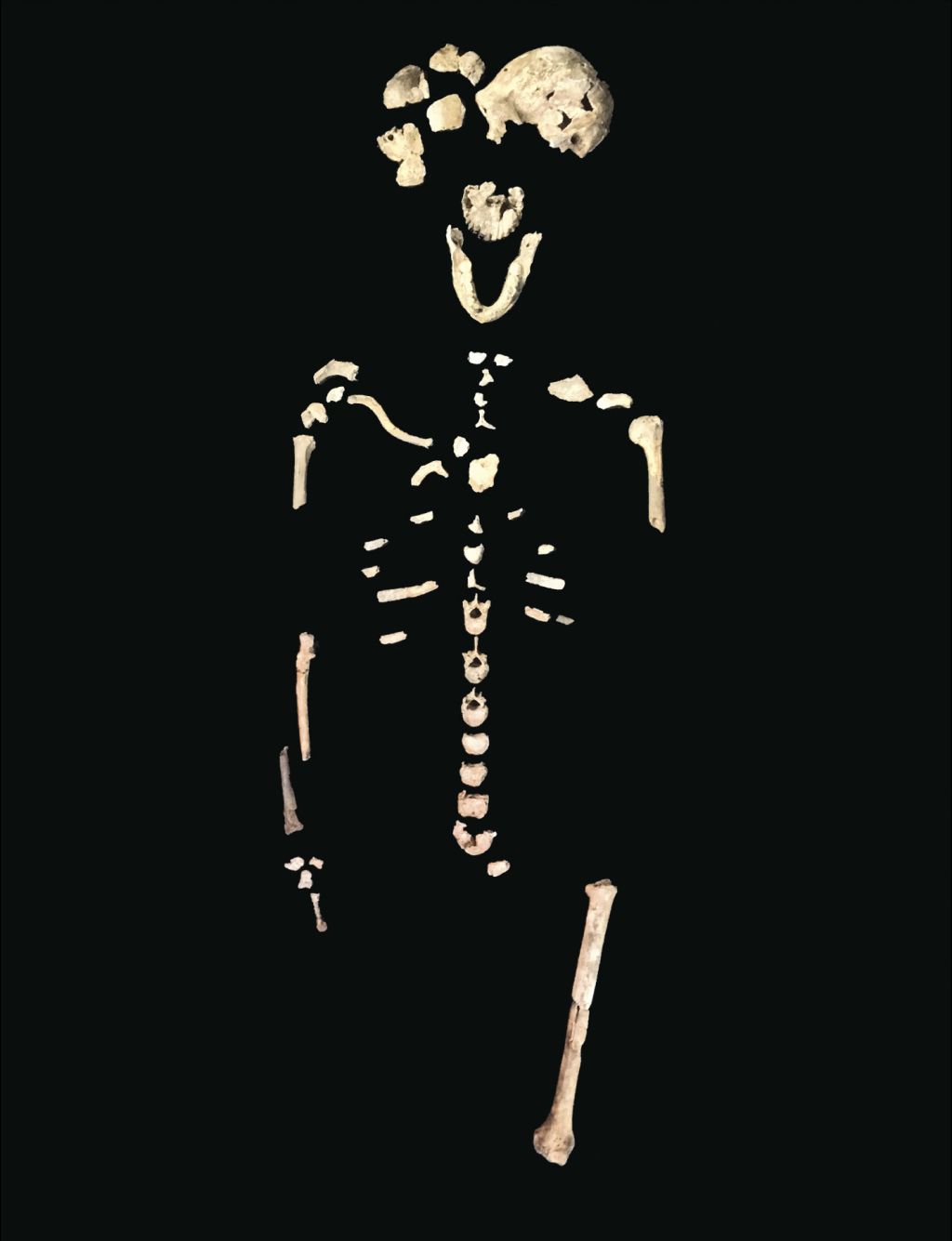 (5) Neo Skeleton Lesedi Chamber